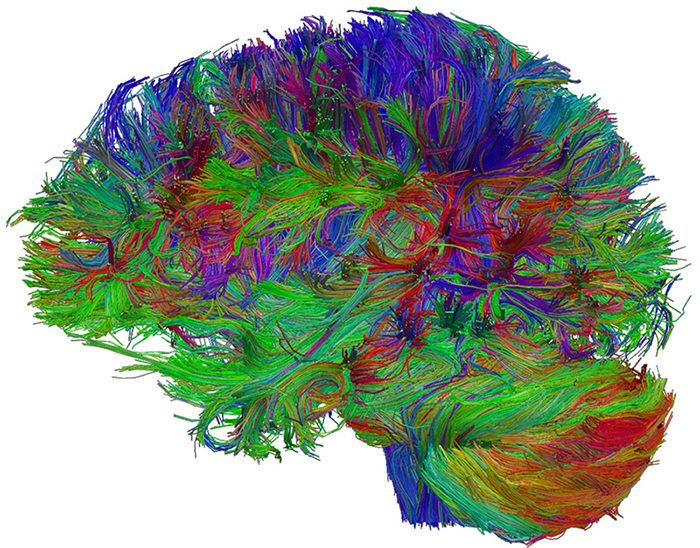 Cerveau humain reconstitué en tractographie © Laurent PETIT  IMN - GIN  CNRS Photothèque
