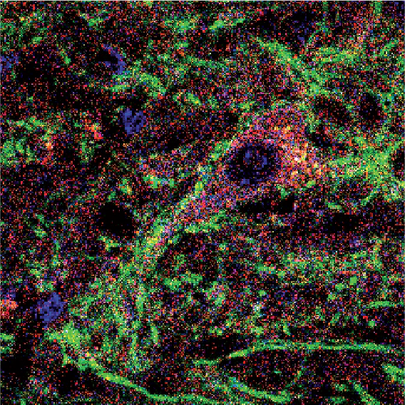 Neurone du cervelet (en rouge) projetant vers le site de genèse des mouvements involontaires dans la maladie de Parkinson. La stimulation intermittente des terminaisons nerveuses (en vert) dans un modèle de Parkinson chez la souris prévient l’apparition de ces mouvements.