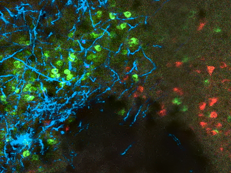 Axones du cervelet Image scientifique
